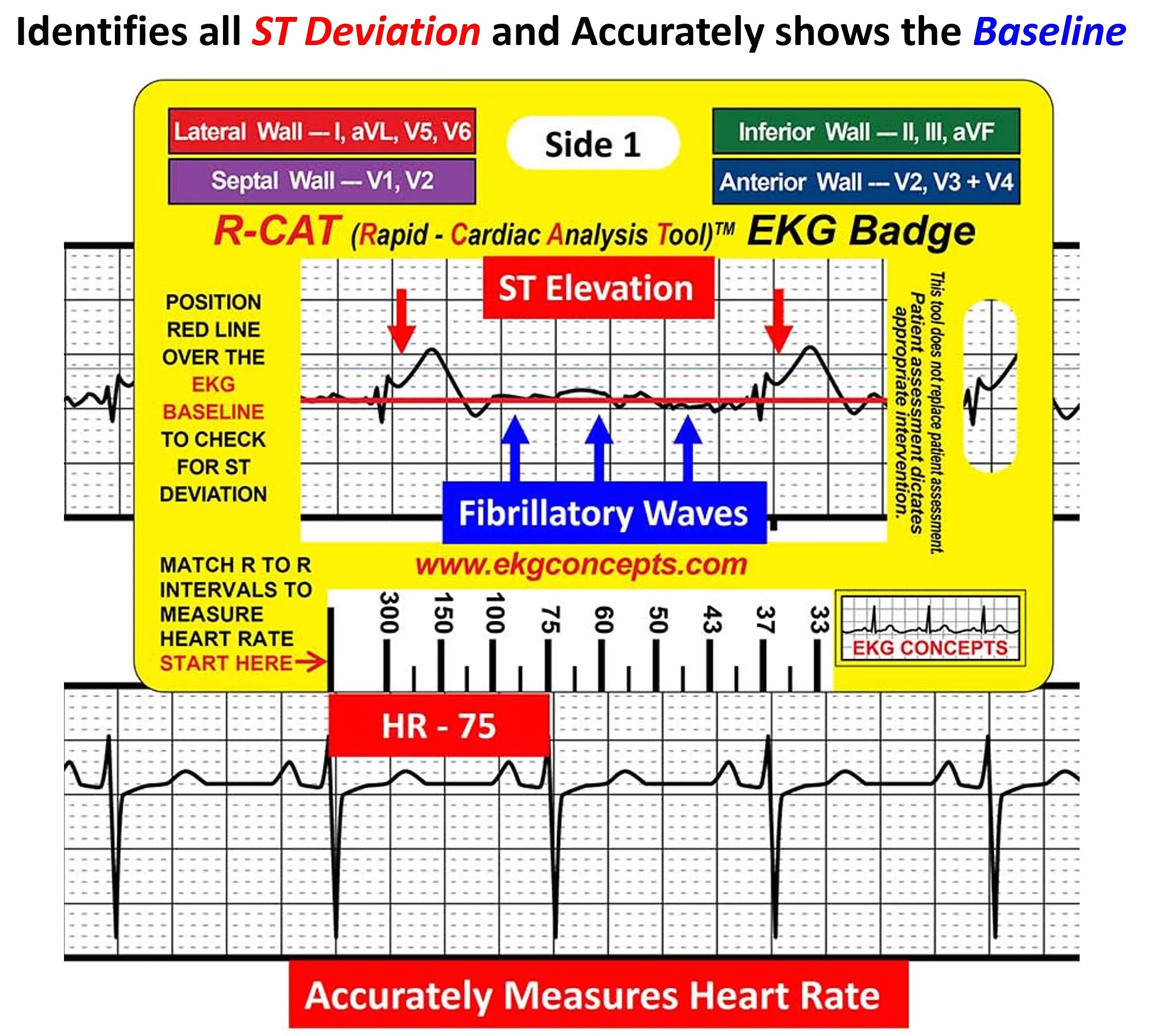 R-Cat Odznaka EKG