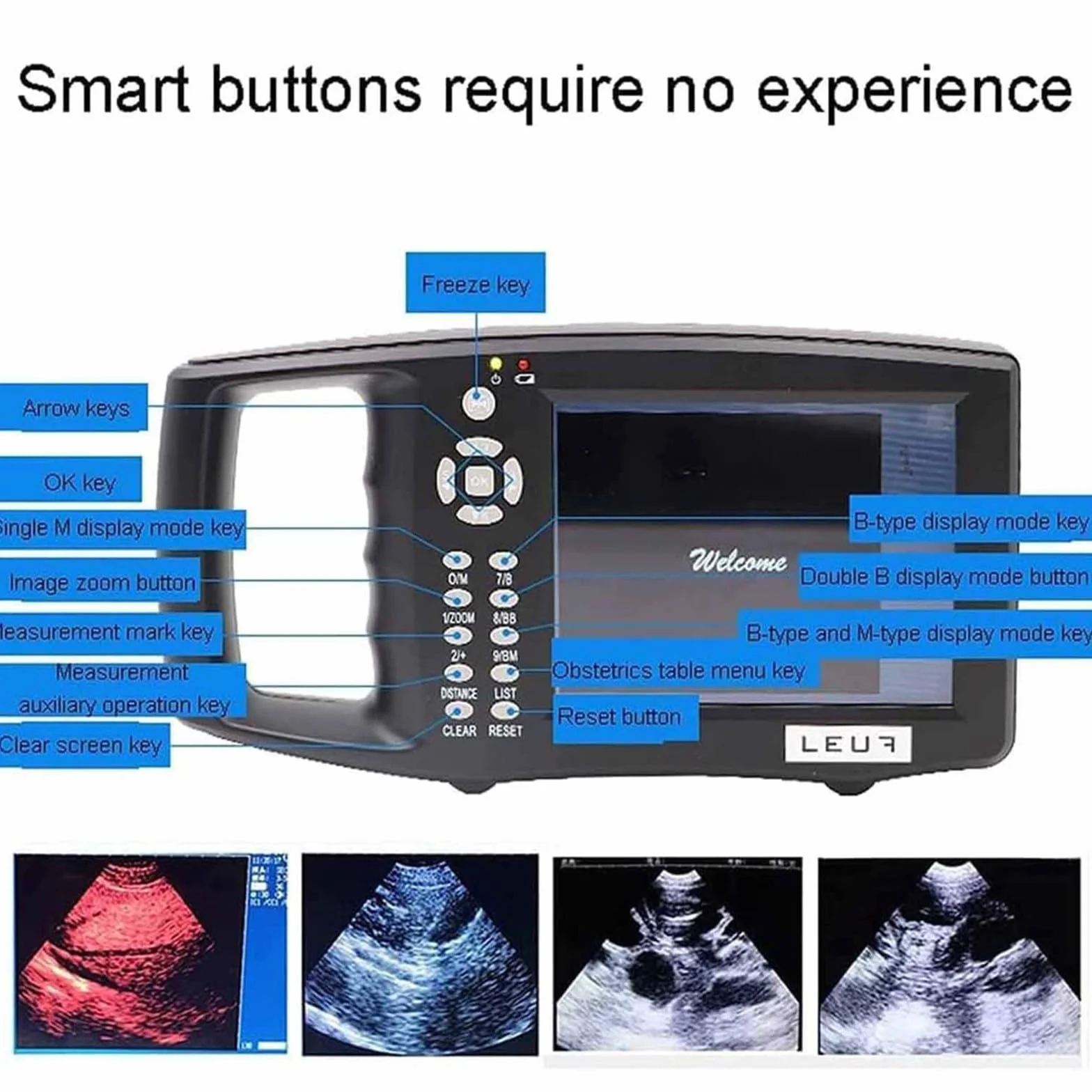 LTSRLL Veterinary Ultrasound Skaner, skaner ultrasonograficzny w celu ręcznego pomocy ciążowej dla weterynarzy, maszyna do skanera ultradźwiękowego z sondą 3,5 MHz dla świń lub owczych