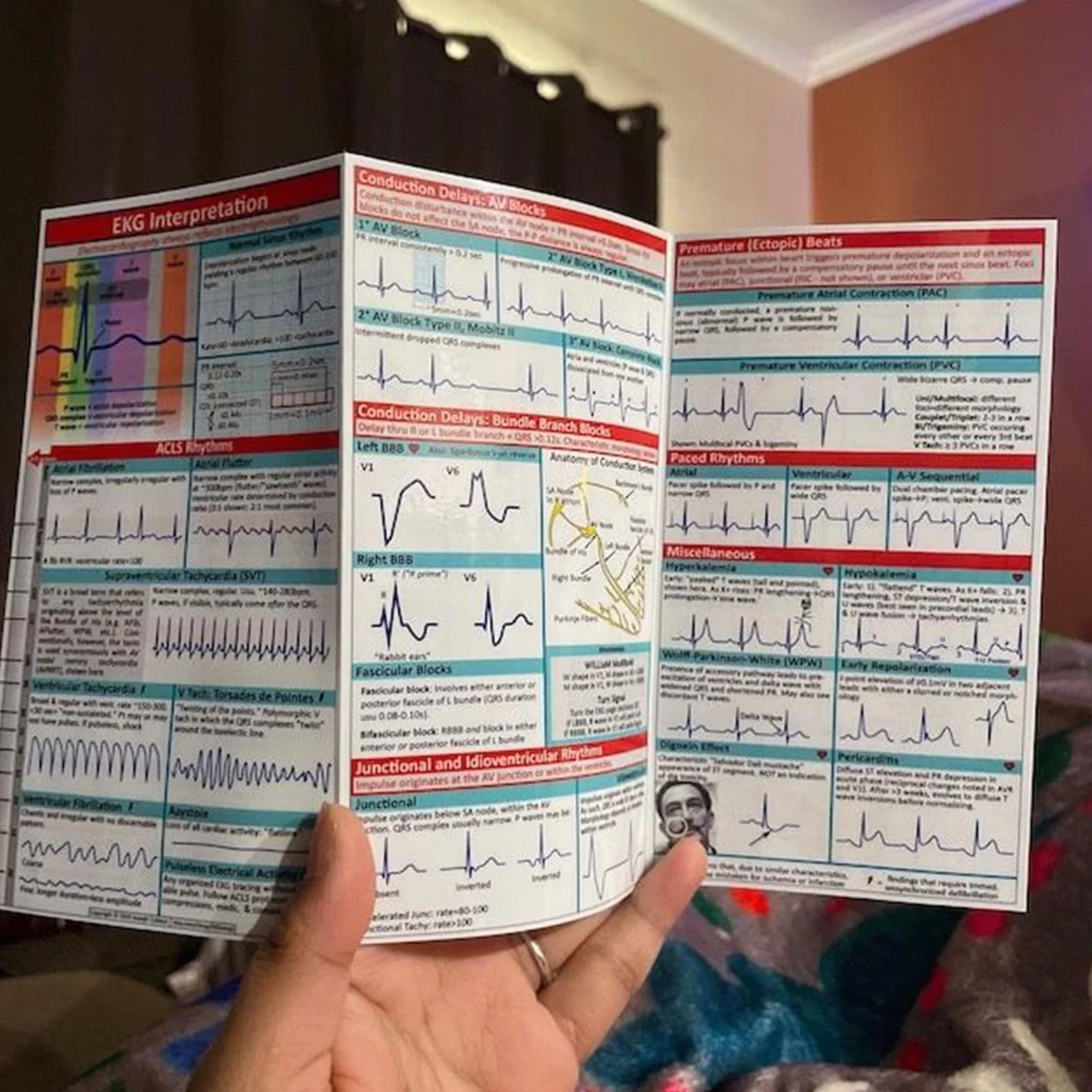 Kieszonkowy przewodnik EKG, karta kieszonkowa EKG, interpretacja rytmu EKG, dwustronna kompaktowa i przenośna karta referencyjna, karty pamięci ratowników medycznych, szybka interpretacja EKG Pocket