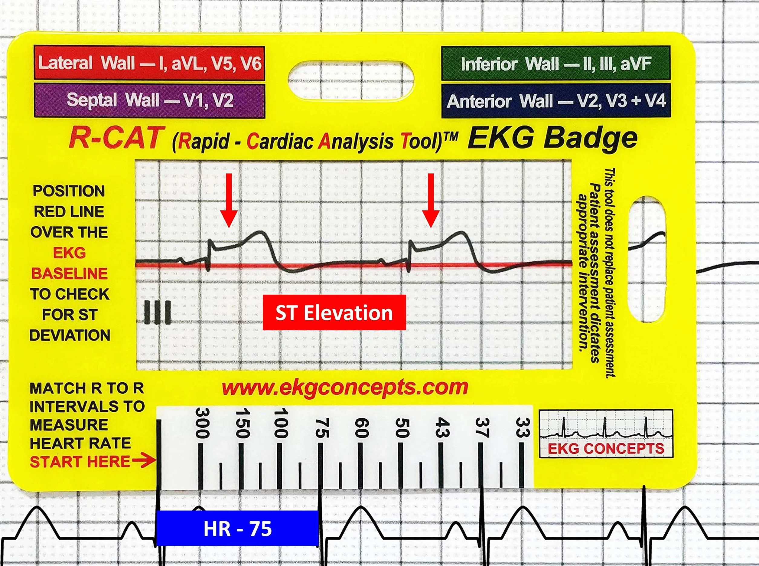 R-Cat Odznaka EKG
