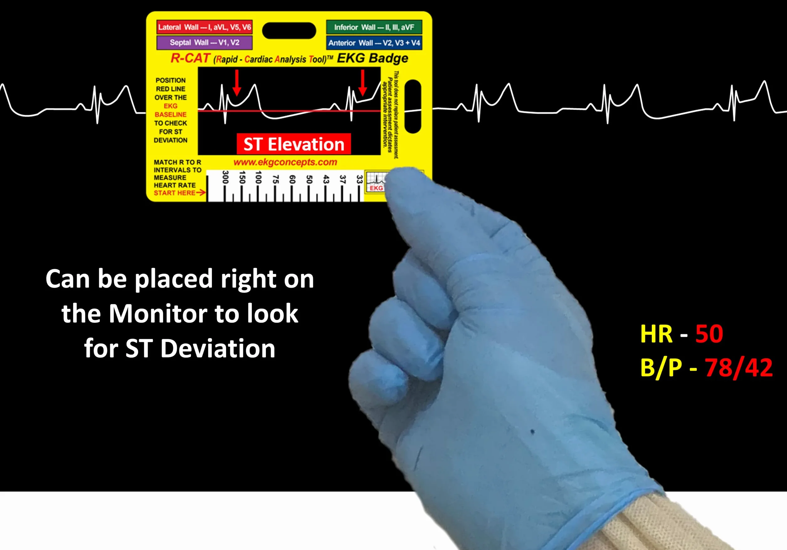 R-Cat Odznaka EKG