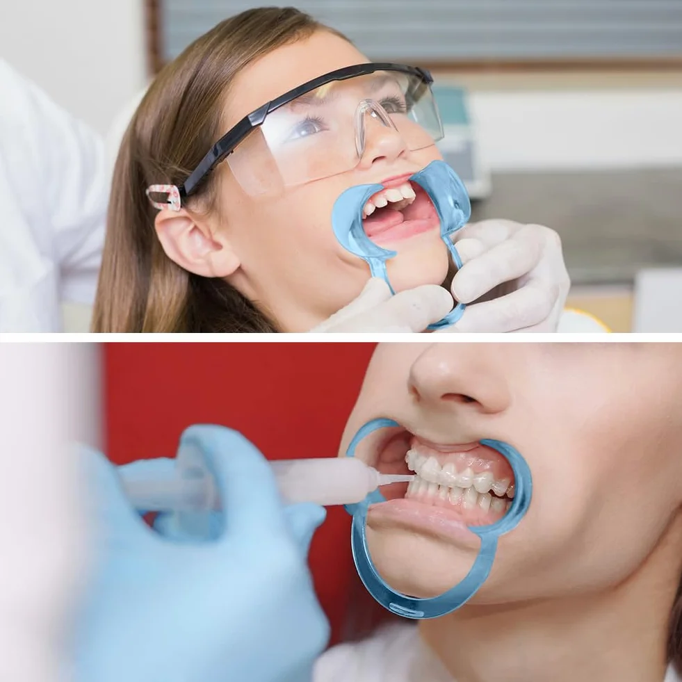 Vicloon Otwieracz do ust dentystycznych 12 szt. w kształcie litery C policzek zwijacze do wybielania zębów niebieski
