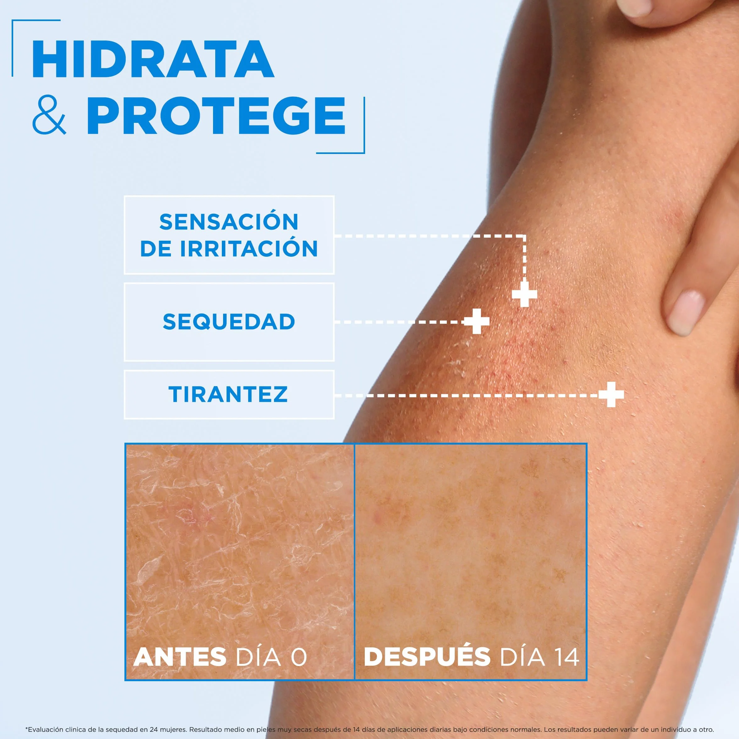 Mixa Ceramide Protect Crema Fortalecedora 400 ml
